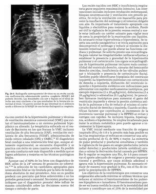 CLINICA QUIRURGICA - Cirugia pediatrica   ashcraft