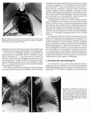 CLINICA QUIRURGICA - Cirugia pediatrica   ashcraft