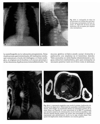 CLINICA QUIRURGICA - Cirugia pediatrica   ashcraft
