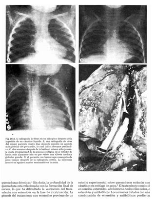 CLINICA QUIRURGICA - Cirugia pediatrica   ashcraft