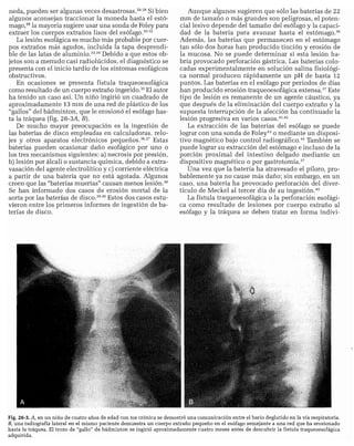 CLINICA QUIRURGICA - Cirugia pediatrica   ashcraft