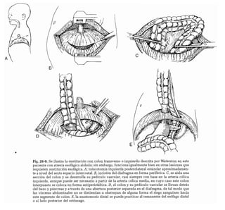CLINICA QUIRURGICA - Cirugia pediatrica   ashcraft