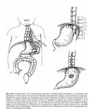 CLINICA QUIRURGICA - Cirugia pediatrica   ashcraft