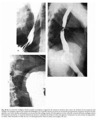 CLINICA QUIRURGICA - Cirugia pediatrica   ashcraft