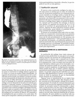 CLINICA QUIRURGICA - Cirugia pediatrica   ashcraft