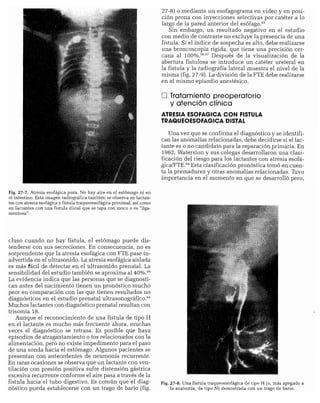 CLINICA QUIRURGICA - Cirugia pediatrica   ashcraft