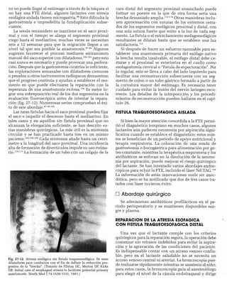 CLINICA QUIRURGICA - Cirugia pediatrica   ashcraft