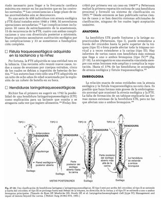 CLINICA QUIRURGICA - Cirugia pediatrica   ashcraft