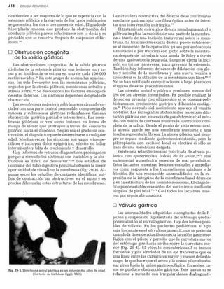 CLINICA QUIRURGICA - Cirugia pediatrica   ashcraft