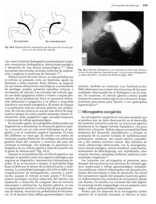 CLINICA QUIRURGICA - Cirugia pediatrica   ashcraft