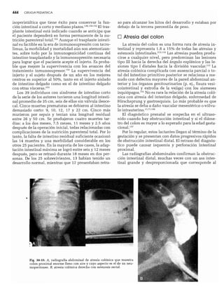 CLINICA QUIRURGICA - Cirugia pediatrica   ashcraft