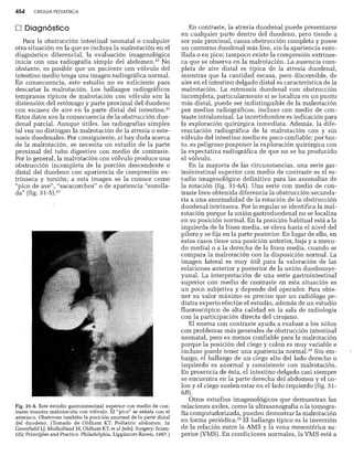 CLINICA QUIRURGICA - Cirugia pediatrica   ashcraft