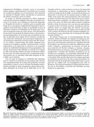CLINICA QUIRURGICA - Cirugia pediatrica   ashcraft