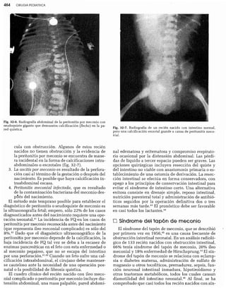 CLINICA QUIRURGICA - Cirugia pediatrica   ashcraft