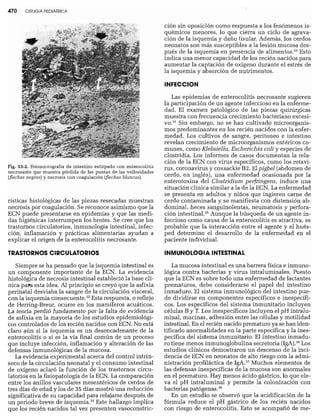 CLINICA QUIRURGICA - Cirugia pediatrica   ashcraft