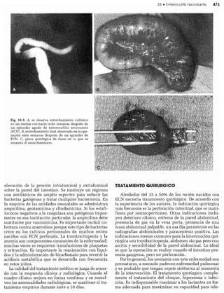 CLINICA QUIRURGICA - Cirugia pediatrica   ashcraft