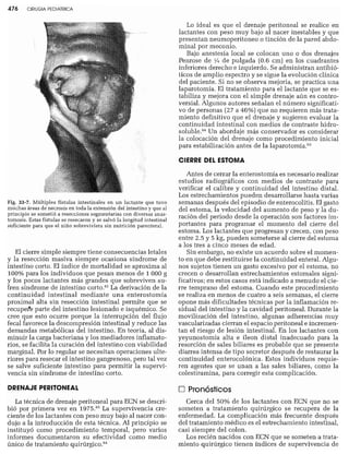 CLINICA QUIRURGICA - Cirugia pediatrica   ashcraft