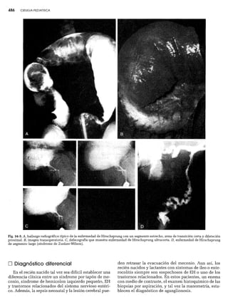 CLINICA QUIRURGICA - Cirugia pediatrica   ashcraft