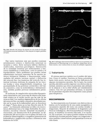 CLINICA QUIRURGICA - Cirugia pediatrica   ashcraft