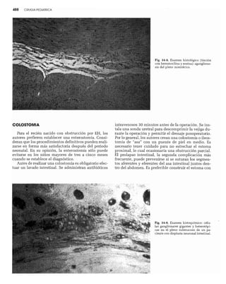 CLINICA QUIRURGICA - Cirugia pediatrica   ashcraft