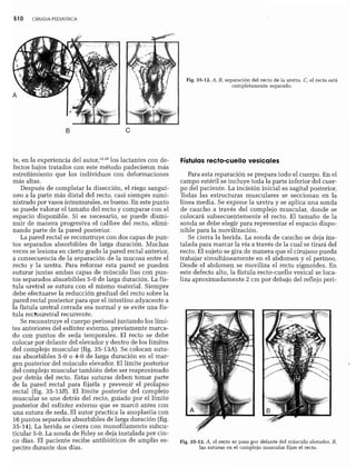 CLINICA QUIRURGICA - Cirugia pediatrica   ashcraft