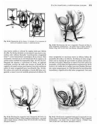 CLINICA QUIRURGICA - Cirugia pediatrica   ashcraft