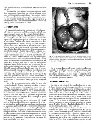 CLINICA QUIRURGICA - Cirugia pediatrica   ashcraft