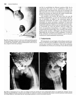 CLINICA QUIRURGICA - Cirugia pediatrica   ashcraft