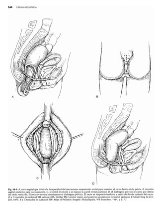 CLINICA QUIRURGICA - Cirugia pediatrica   ashcraft