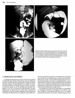 CLINICA QUIRURGICA - Cirugia pediatrica   ashcraft