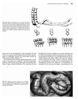 CLINICA QUIRURGICA - Cirugia pediatrica   ashcraft