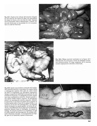 CLINICA QUIRURGICA - Cirugia pediatrica   ashcraft