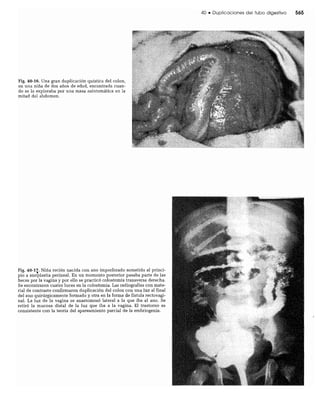 CLINICA QUIRURGICA - Cirugia pediatrica   ashcraft