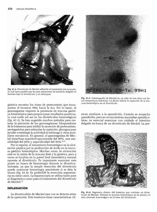 CLINICA QUIRURGICA - Cirugia pediatrica   ashcraft
