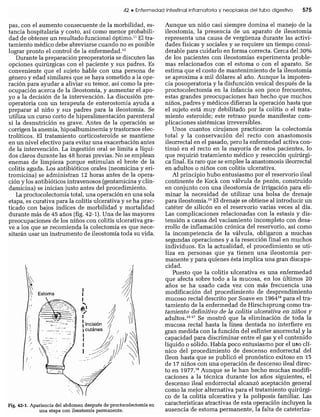 CLINICA QUIRURGICA - Cirugia pediatrica   ashcraft