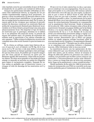 CLINICA QUIRURGICA - Cirugia pediatrica   ashcraft