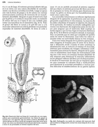 CLINICA QUIRURGICA - Cirugia pediatrica   ashcraft