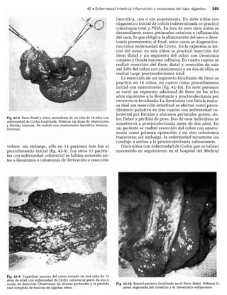 CLINICA QUIRURGICA - Cirugia pediatrica   ashcraft