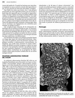 CLINICA QUIRURGICA - Cirugia pediatrica   ashcraft