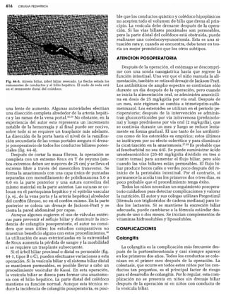 CLINICA QUIRURGICA - Cirugia pediatrica   ashcraft