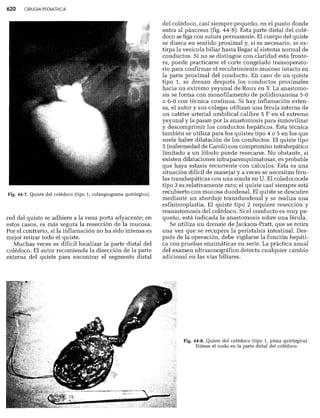 CLINICA QUIRURGICA - Cirugia pediatrica   ashcraft