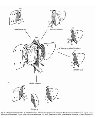 CLINICA QUIRURGICA - Cirugia pediatrica   ashcraft