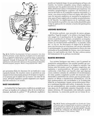 CLINICA QUIRURGICA - Cirugia pediatrica   ashcraft