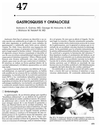 CLINICA QUIRURGICA - Cirugia pediatrica   ashcraft