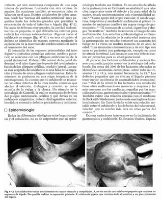 CLINICA QUIRURGICA - Cirugia pediatrica   ashcraft