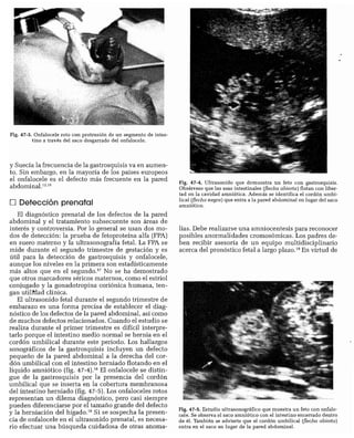 CLINICA QUIRURGICA - Cirugia pediatrica   ashcraft
