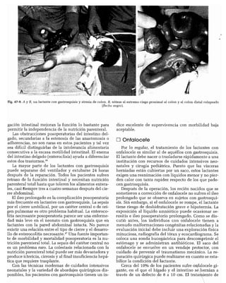 CLINICA QUIRURGICA - Cirugia pediatrica   ashcraft