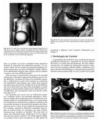 CLINICA QUIRURGICA - Cirugia pediatrica   ashcraft