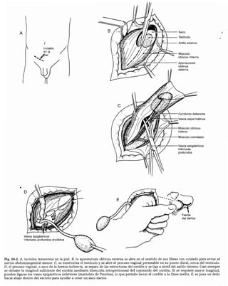 CLINICA QUIRURGICA - Cirugia pediatrica   ashcraft