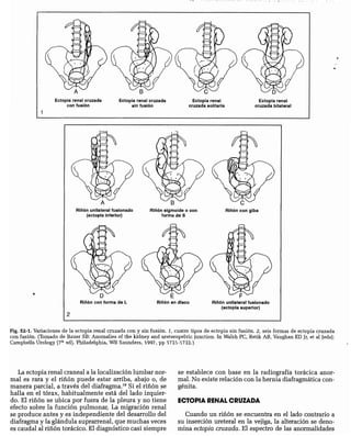 CLINICA QUIRURGICA - Cirugia pediatrica   ashcraft